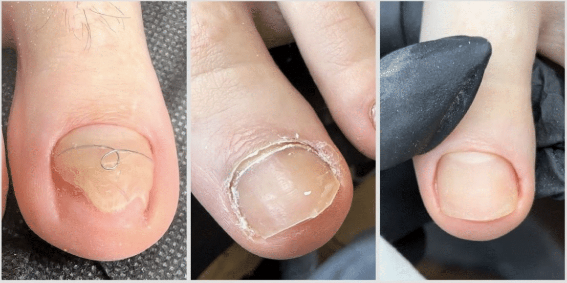 A-SKY Salon Redefines Pedicures with Innovative Procedure