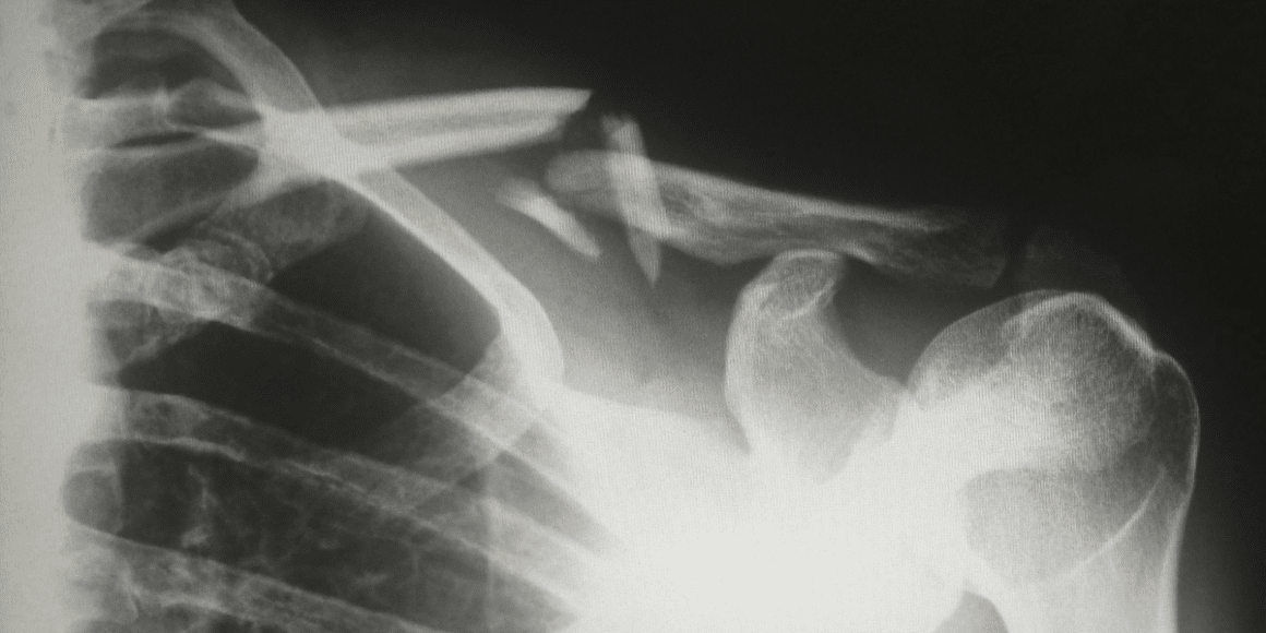Understanding Fault in Injury Cases What You Need to Know