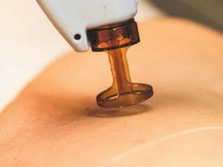 Athletic Recovery Care at Hollywood Laser Pain Center