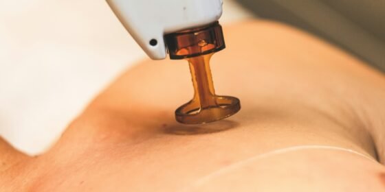 Athletic Recovery Care at Hollywood Laser Pain Center