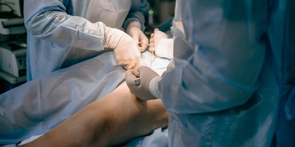 Radio Frequency Treatment for Varicose Veins: A Full-Body Reset
