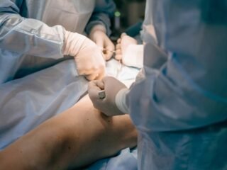 Radio Frequency Treatment for Varicose Veins: A Full-Body Reset